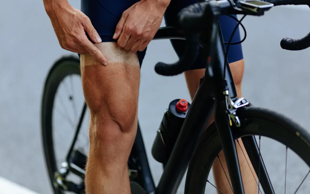 L’aloe vera : Une Solution Naturelle pour Apaiser les Coups de Soleil et les Irritations Cutanées