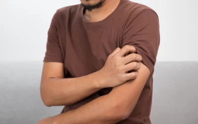 Soulager les piqûres d’insectes avec l’aloe vera