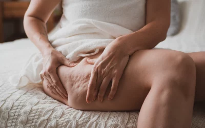 L’aloe vera pour favoriser la circulation sanguine et réduire la cellulite